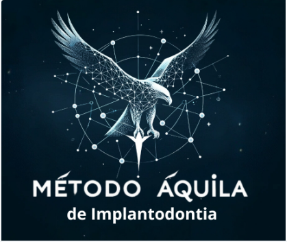 Método Áquila de Implantodontia